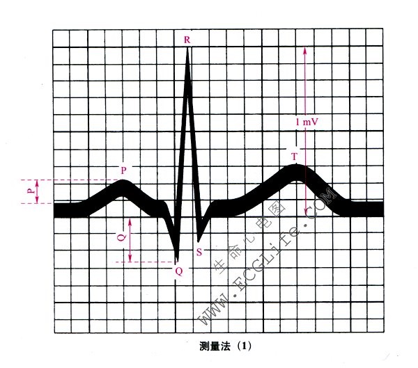 心电图的测量方法、原则