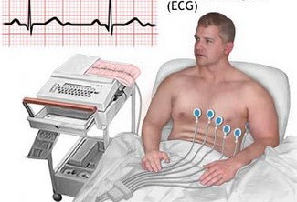 用心电图可以对心脏作出的诊断