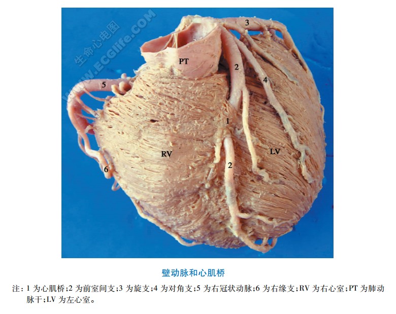 心脏壁动脉（穿过心肌桥的动脉）