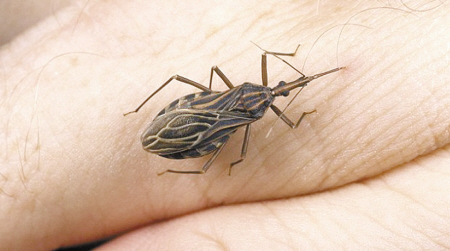 椎猎蝽病：猎蝽叮咬及引起的皮肤反应