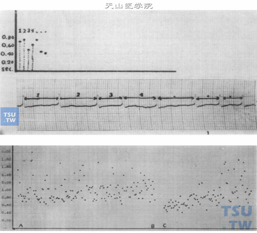  上图是RR间期描记图的制作方法，下图是描记录的时间RR间期散点图［引自American heart journal，1950，40（2）：212-223］