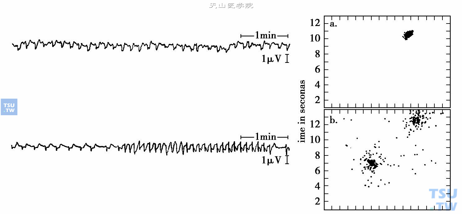  犬胃的电活动，上图为慢频率，下图为两个不同频率的联合时距直方图（引自Biophysical journal，1962，2：351-368）