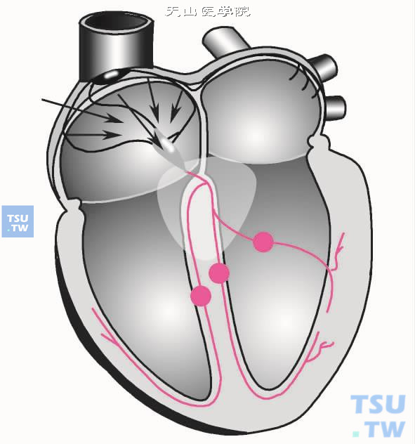 心房颤动与扑动的发生机制与心电图RR序列特征