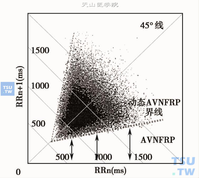  心电散点图中AVNFRP特征