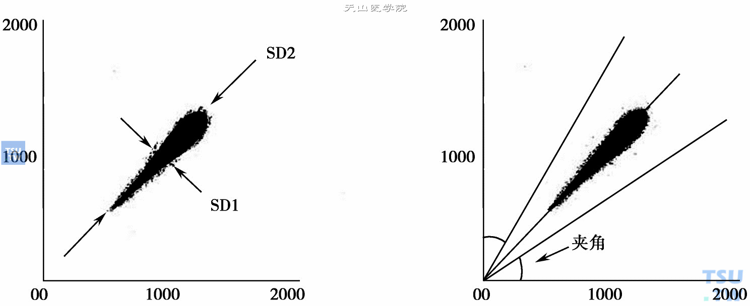 心电散点图的长短轴测量方法及矢量角度