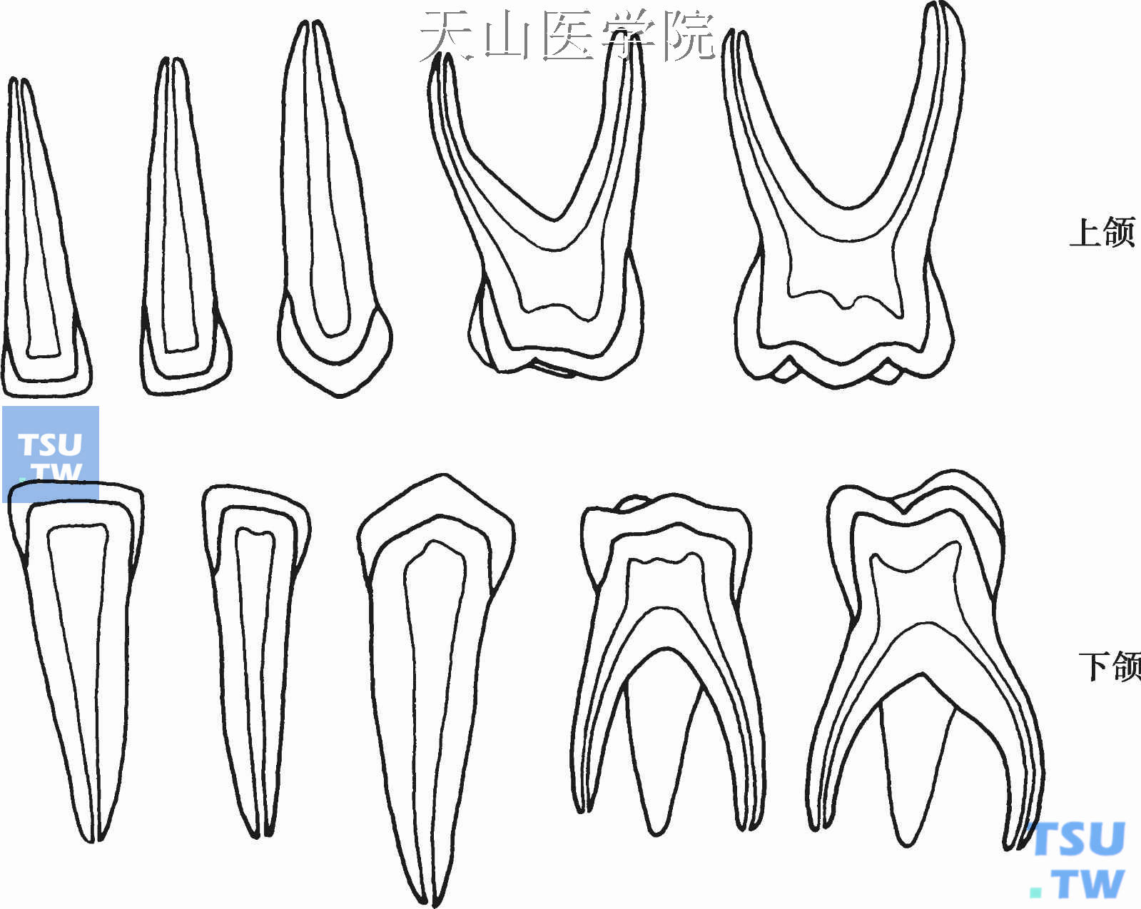 牙髓腔解剖:前牙,磨牙,乳牙髓腔