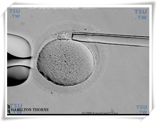 胚胎植入前遗传学诊断/筛查（PGD/PGS）实验室活检