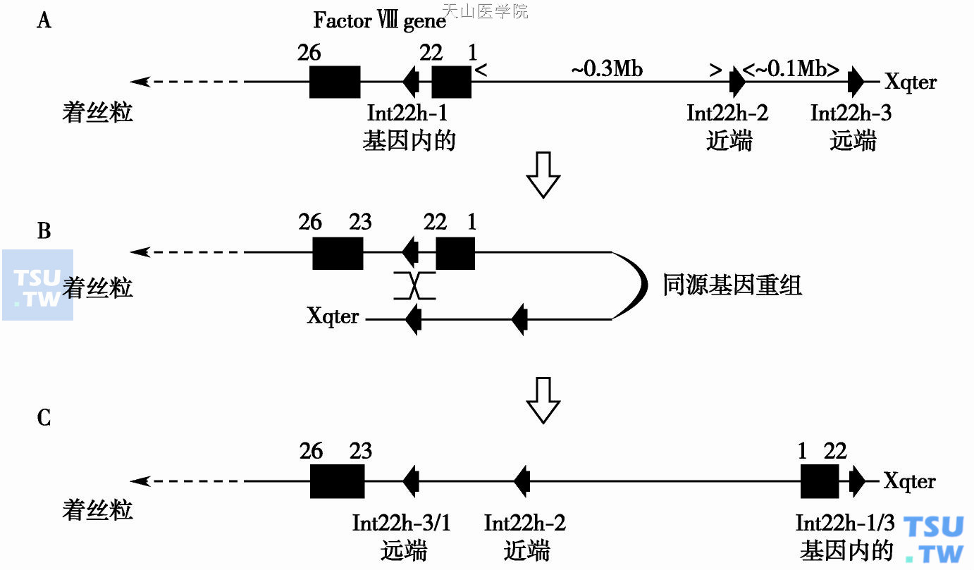 A.正常的FⅧ基因和Int22h同源基因的构型；B.在Int22h基因内部同源基因的远端或近端发生调整，发生同源基因重组；C.从外显子1到外显子22反转，因此，FⅧ的转录过程被打断，不能产生正常的FⅧ