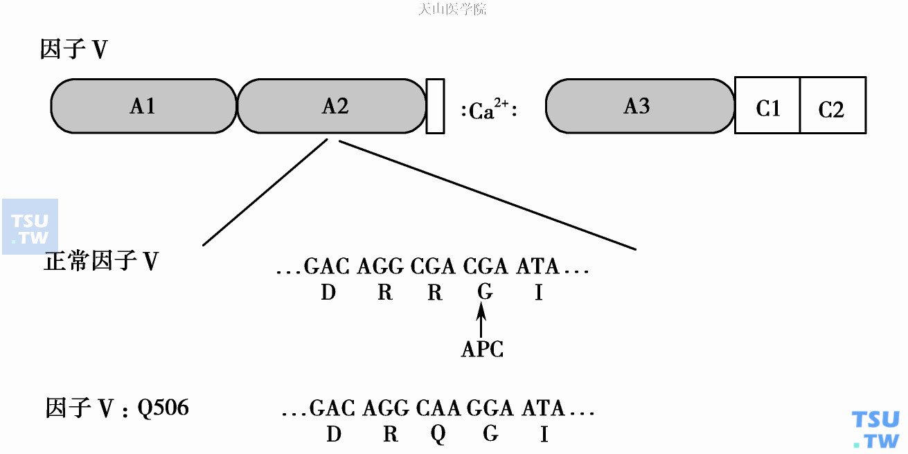  图2　先天性活化蛋白C抵抗症患者（APC- R）FⅤ的变异