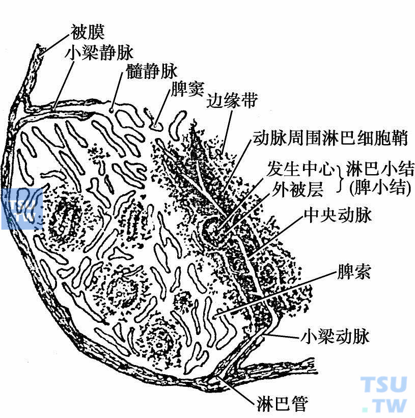 脾玻璃样变手绘图图片