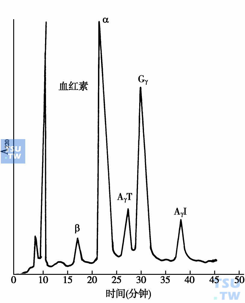  人脐带血中各种珠蛋白链的HPLC分离图