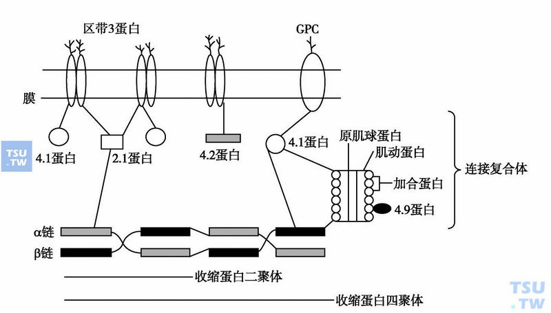 遗传性球形红细胞增多症的发病机制