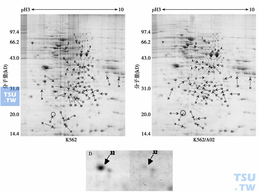  双向凝胶电泳法分析多药耐药细胞株K562/A02和其亲代细胞株K562中基因表达差异，32号为Sorcin基因表达蛋白