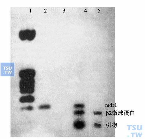 RT-PCR法检测K562及K562/A02细胞中mdr1基因表达；1，Marker，2，mdr1 cDNA，3，mdr2 cDNA，4，K562及K562/A02，5，K562
