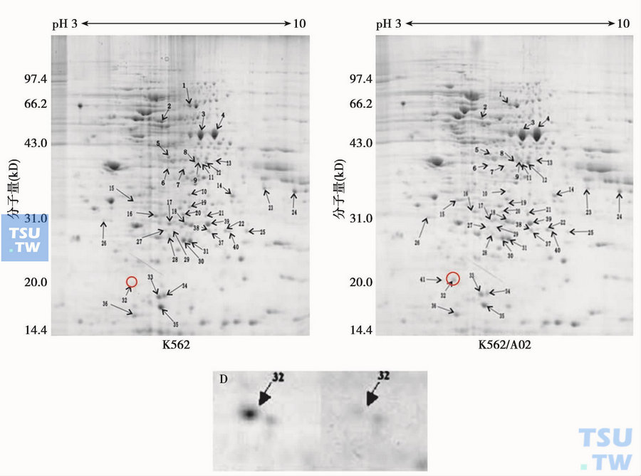 双向凝胶电泳法分析多药耐药细胞株K562/A02和其亲代细胞株K562中基因表达差异，32号为Sorcin基因表达蛋白