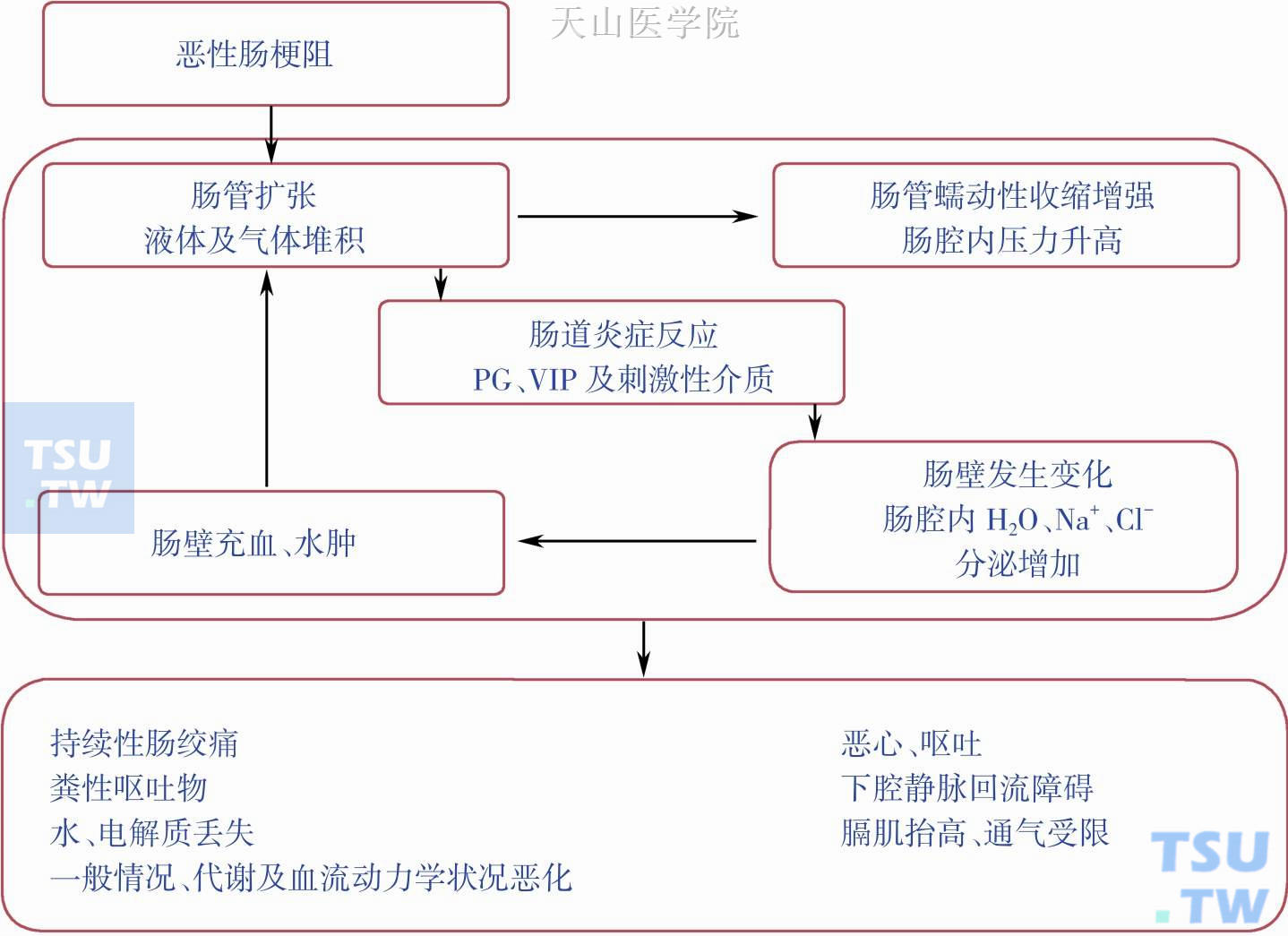 恶性肠梗阻的病理生理：PG，prostaglandins，前列腺素；VIP，vasoactiveintestinal polypeptide，血管活性肠肽