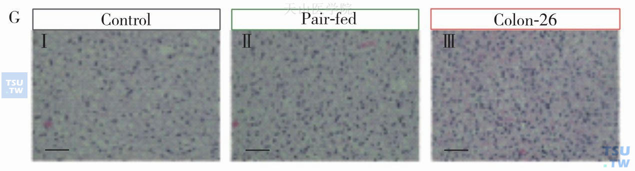 苏木素和伊红对棕色脂肪组织的染色结果，分别在自由进食组（ⅰ）、配对喂养对照组（ⅱ）C26肿瘤组（ⅲ）小鼠组织切片显示。黑色标尺表示50µm