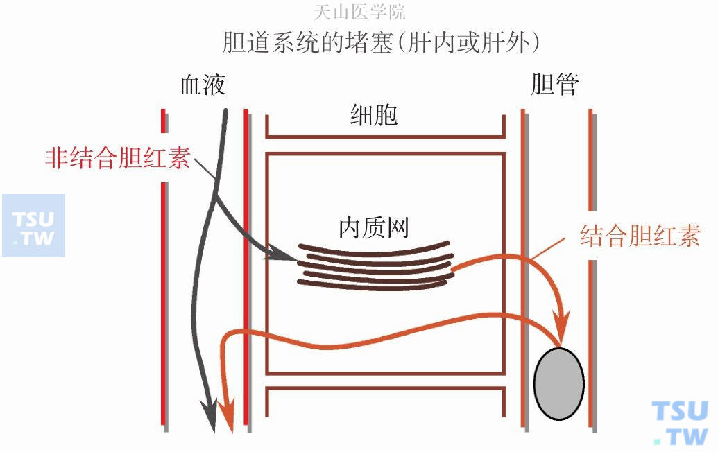 胆汁淤积性黄疸机制图