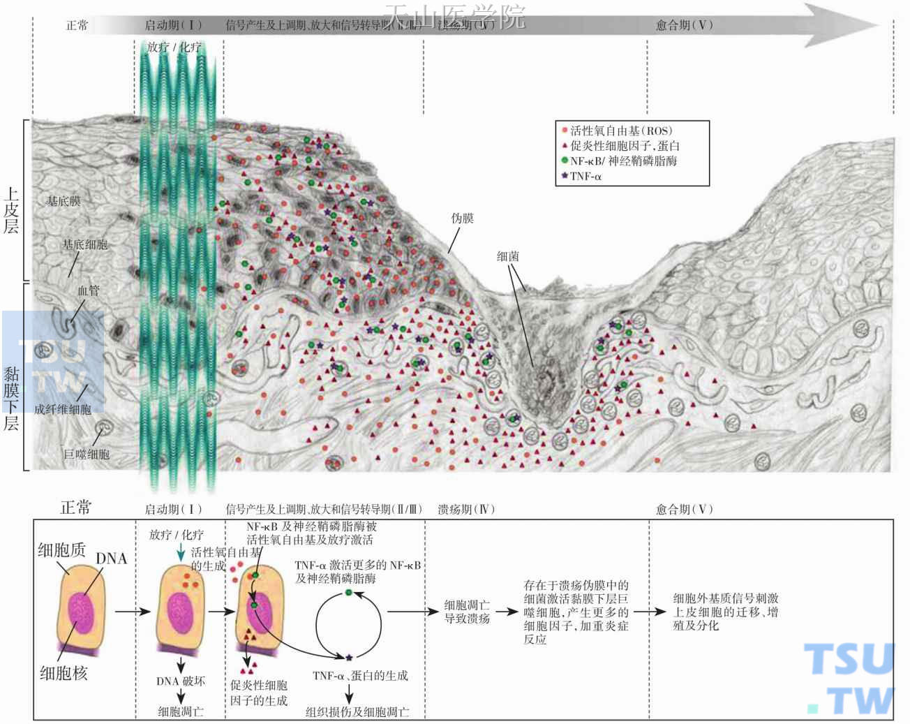 黏膜炎病理生理过程的五个阶段。黏膜炎病理生理过程可分为五个阶段：启动期、信号产生及上调期、放大和信号转导期、溃疡期、愈合期
