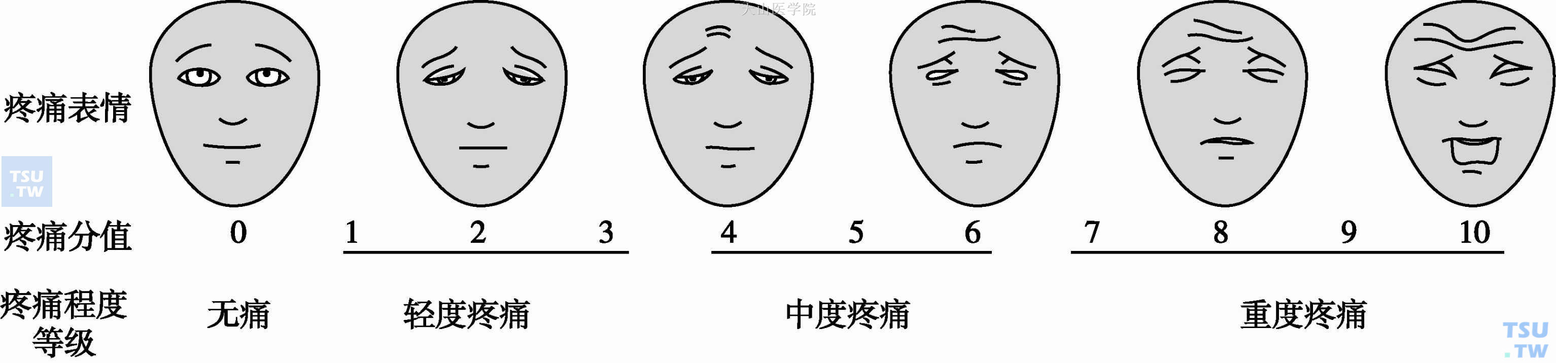 面部表情疼痛评分量表
