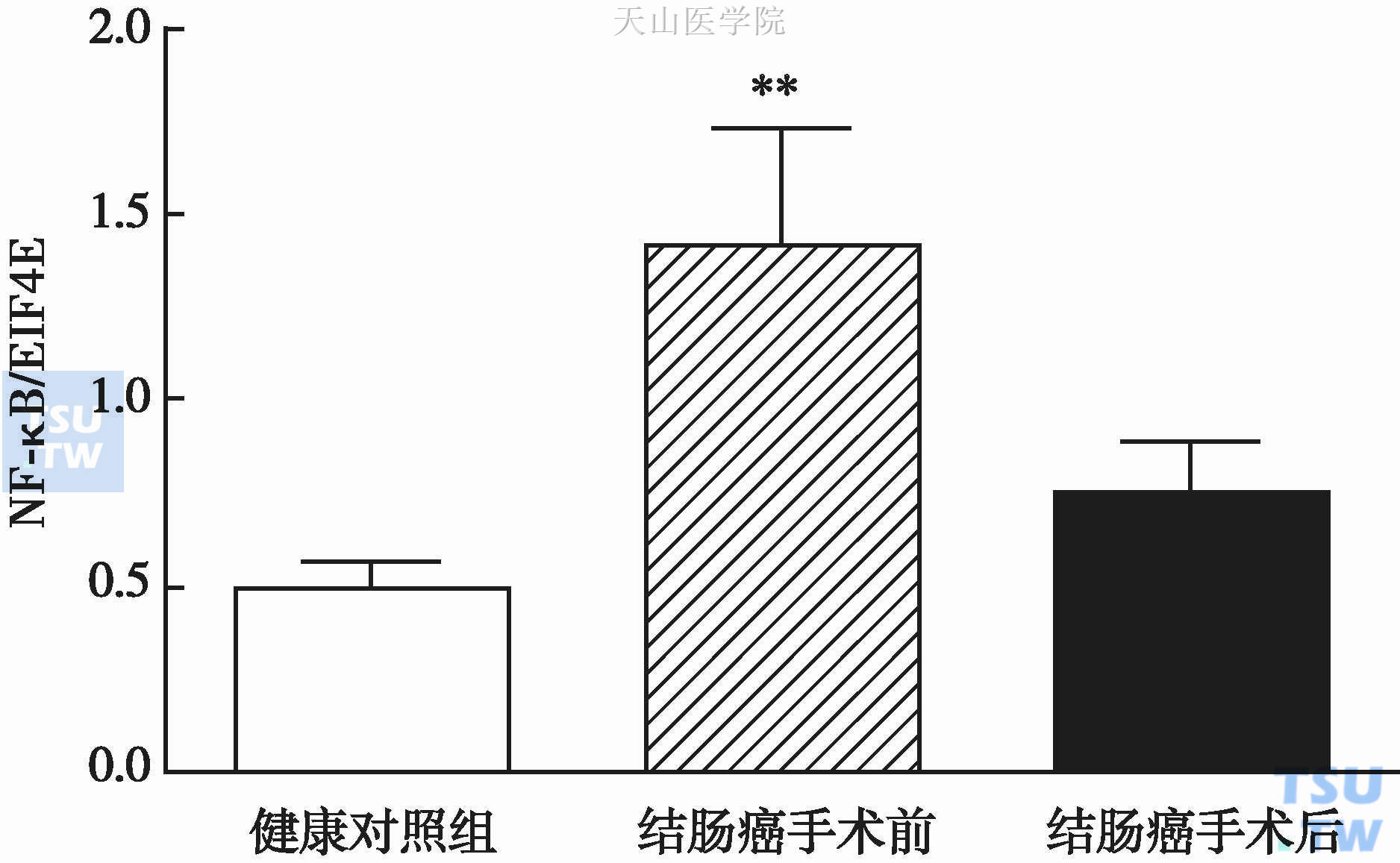 结肠癌患者手术前后肌肉NF-κB活性变化