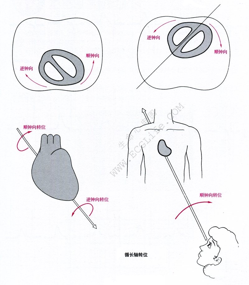 心脏长轴位示意图图片