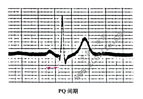 PR（PQ）间期