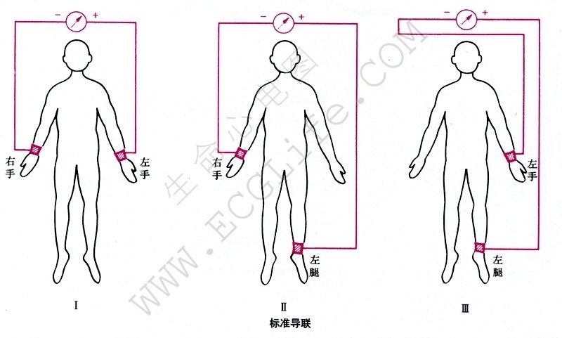 心电图导联位置 四肢图片