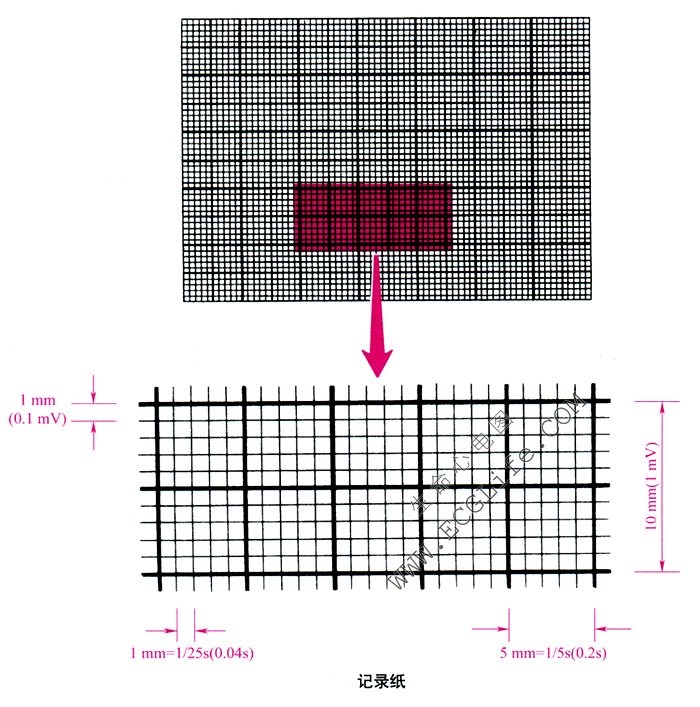 心电图记录纸