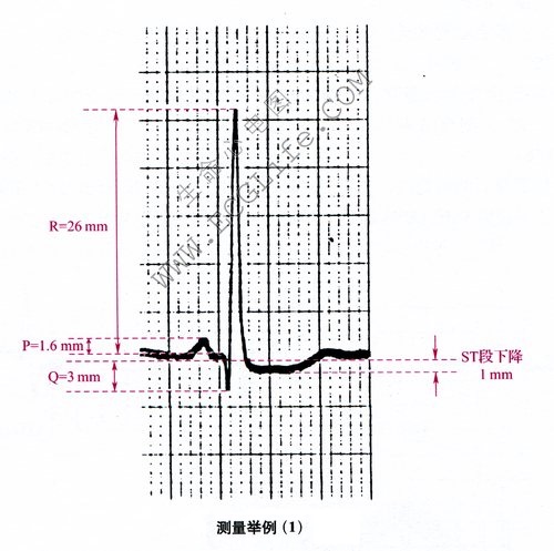 测量例举1