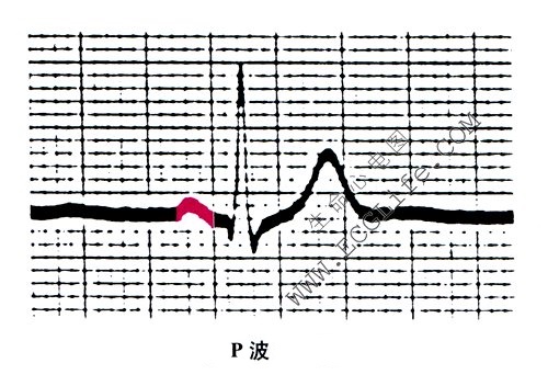 心电图波段的名称和意义