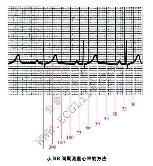 从RR间期测量心率的方法