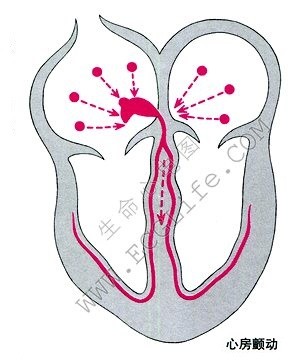 心房颤动、心房扑动