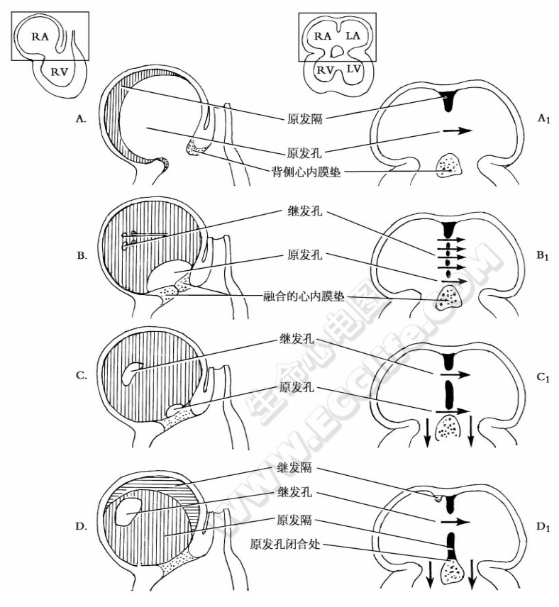 心脏生长过程中原始心房的分隔过程1