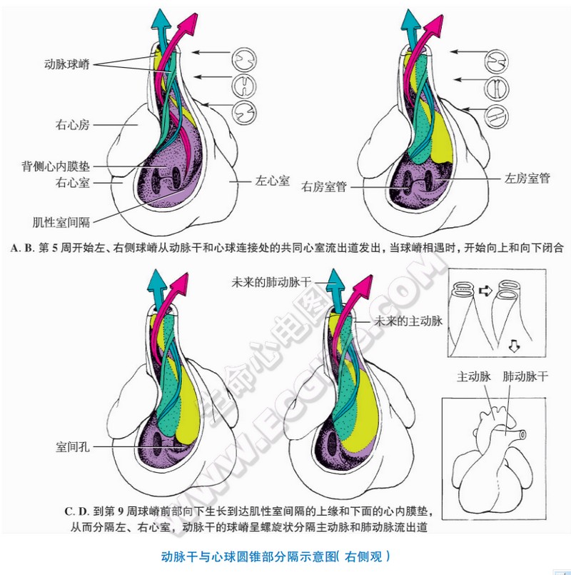 动脉干与心球圆锥部分隔示意图（右侧观）