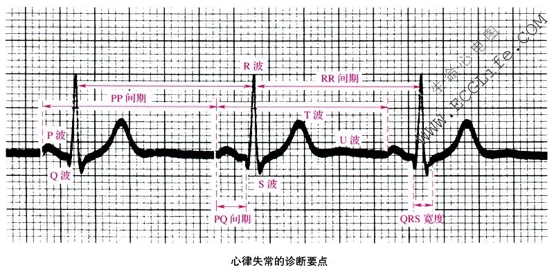 心律失常的心电图诊断要点