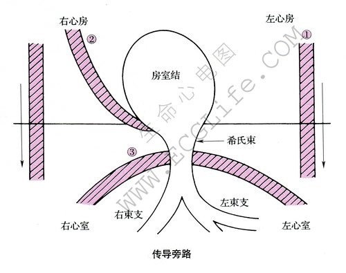 传导旁路示意图