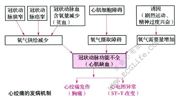 心绞痛的发病机制