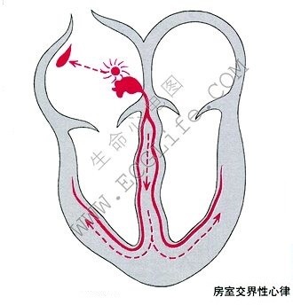 房室交界性心律