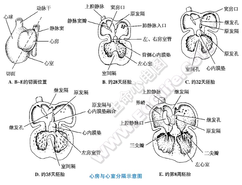 心室图解图片