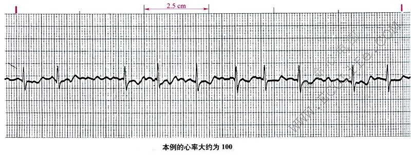 本例的心率大约为100