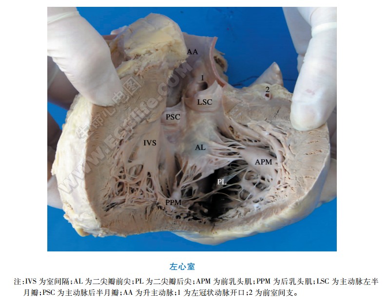左心室解剖图