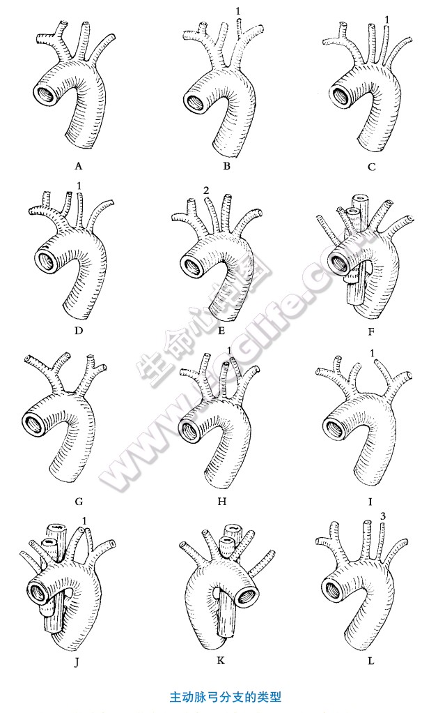 主动脉弓分支的类型