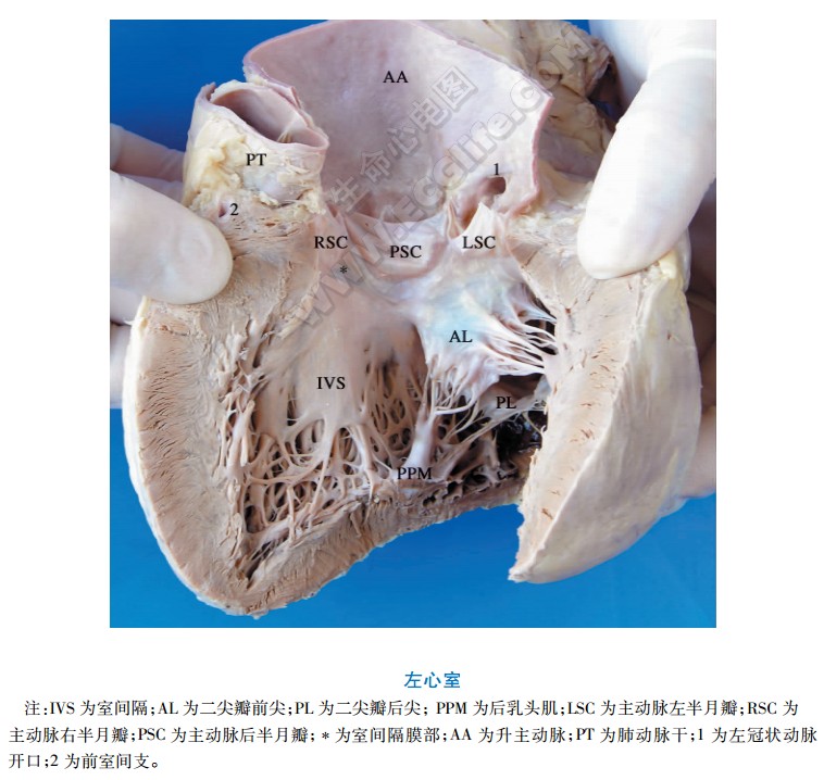 左心室内部解剖图