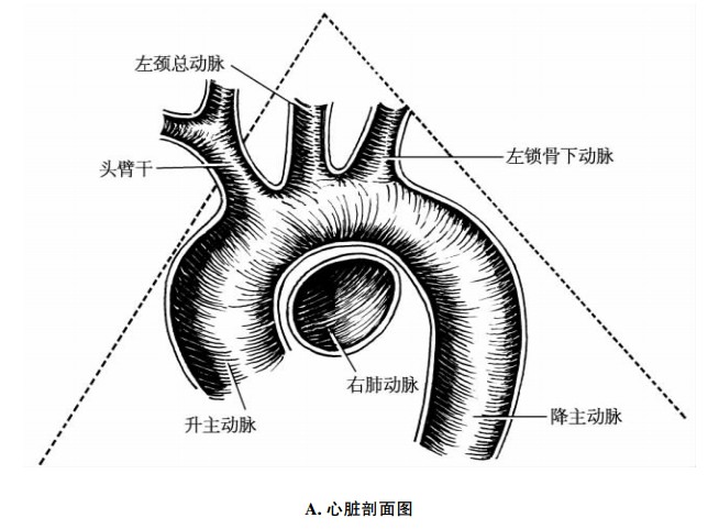 主动脉弓剖面图