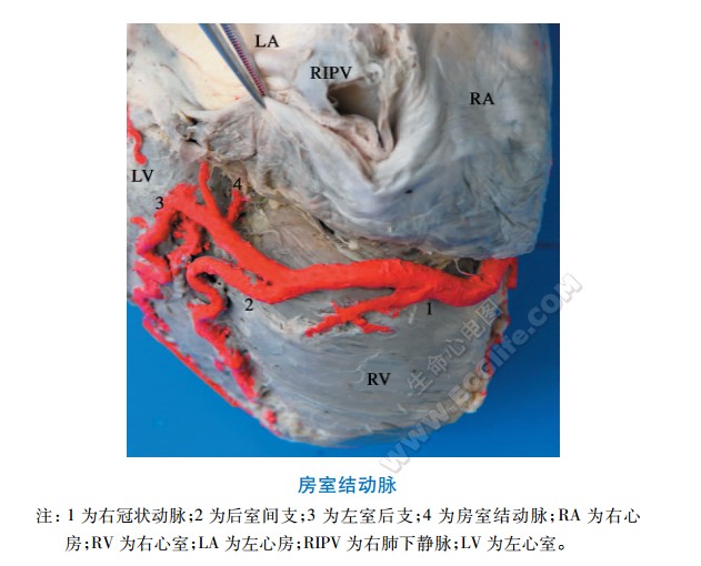 房室结动脉分布解剖图