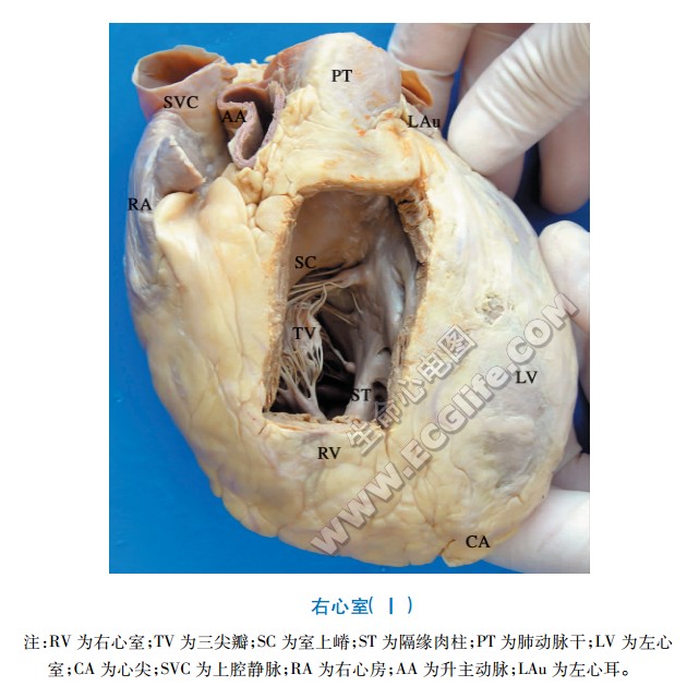 右心室腔内结构解剖图1