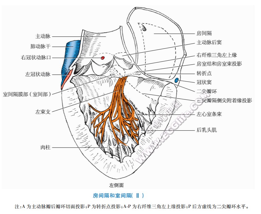 室间隔解剖示意图图片