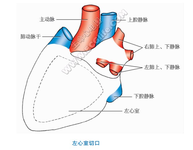 左心室解剖切口