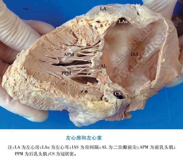 左心房腔内结构解剖图2